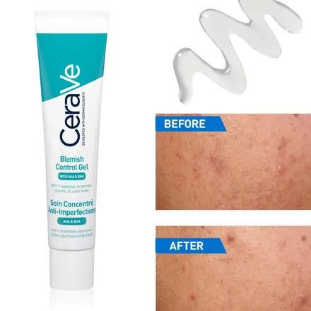 CeraVe